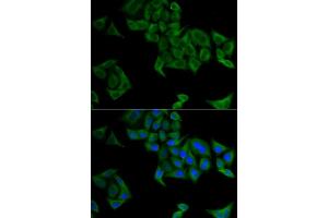 Immunofluorescence analysis of  cells using SMYD5 antibody (ABIN6129324, ABIN6148173, ABIN6148174 and ABIN6221783). (SMYD5 antibody)