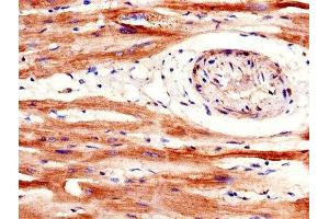 IHC image of ABIN7168677 diluted at 1:600 and staining in paraffin-embedded human heart tissue performed on a Leica BondTM system.