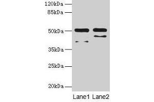 Western blot All lanes: CRHR1 antibody at 16 μg/mL Lane 1: Hela whole cell lysate Lane 2: HL60 whole cell lysate Secondary Goat polyclonal to rabbit IgG at 1/10000 dilution Predicted band size: 51, 48, 44, 47, 29 kDa Observed band size: 51 kDa