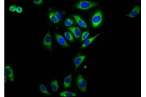 Immunofluorescence staining of A549 cells with ABIN7167433 at 1:230, counter-stained with DAPI. (RAMP2 antibody  (AA 43-145))
