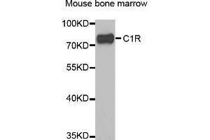 Western blot analysis of extracts of mouse bone marrow, using C1R antibody (ABIN5973769) at 1/1000 dilution. (C1R antibody)
