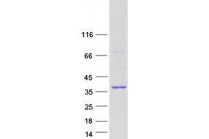 Validation with Western Blot (GEMIN8 Protein (Transcript Variant 1) (Myc-DYKDDDDK Tag))