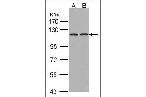 Sample(30 µg whole cell lysate). (ENPEP antibody  (Tyr182))