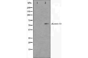 Western blot analysis on HeLa cell lysate using Keratin 10 Antibody. (Keratin 10 antibody  (Internal Region))