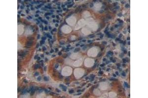 Used in DAB staining on fromalin fixed paraffin- embedded Kidney tissue (ACTN3 antibody  (AA 162-416))
