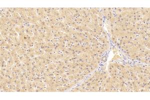 Detection of ALT in Human Liver Tissue using Monoclonal Antibody to Alanine Aminotransferase (ALT) (ALT antibody  (AA 255-492))