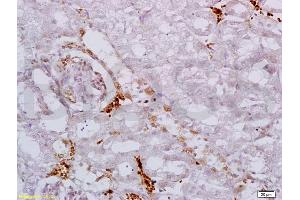 Formalin-fixed and paraffin embedded mouse kidney labeled with Anti AAK1 Polyclonal Antibody, Unconjugated (ABIN687517) at 1:200 followed by conjugation to the secondary antibody and DAB staining (AAK1 antibody  (AA 301-400))