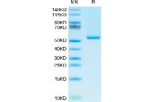 Human 4-1BB Ligand Trimer on Tris-Bis PAGE under reduced condition. (TNFSF9 Protein (Trimer) (His tag))
