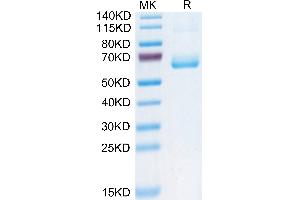 SDS-PAGE (SDS) image for Killer Cell Lectin-Like Receptor Subfamily B, Member 1 (KLRB1) (AA 67-225) protein (Fc Tag) (ABIN7274074)