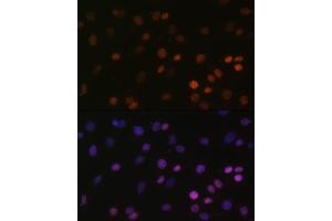 Immunofluorescence analysis of C6 cells using MonoMethyl-Histone H2B-K5 antibody (ABIN7267735) at dilution of 1:100. (Histone H2B antibody  (meLys5))