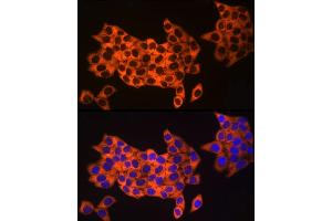Immunofluorescence analysis of HeLa cells using UB Rabbit mAb (ABIN7271128) at dilution of 1:50 (40x lens). (UBA52 antibody)