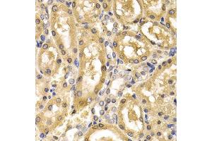 Immunohistochemistry of paraffin-embedded rat kidney using ADH4 antibody at dilution of 1:200 (400x lens).