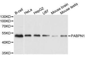 Western blot analysis of extracts of various cell lines, using PABPN1 antibody.