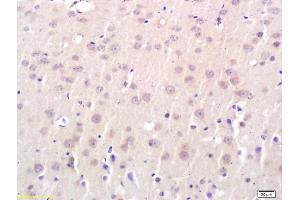 Formalin-fixed and paraffin embedded rat brain labeled with Anti-Connexin-32 Polyclonal Antibody, Unconjugated (ABIN685672) followed by conjugation to the secondary antibody and DAB staining (GJB1 antibody  (AA 201-283))