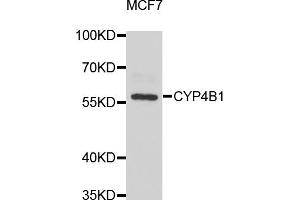 Western blot analysis of extracts of MCF-7 cells, using CYP4B1 antibody (ABIN5975064) at 1/1000 dilution. (CYP4B1 antibody)