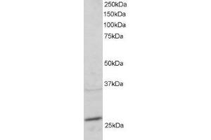 ABIN2564836 staining (2µg/ml) of mouse heart lysate (RIPA buffer, 30µg total protein per lane). (RAB11A antibody  (C-Term))