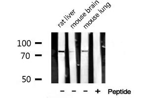Western blot analysis of extracts of various tissue ,using SENP1 antibody. (SENP1 antibody  (N-Term))