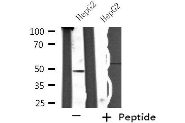 SH2D2A antibody  (C-Term)