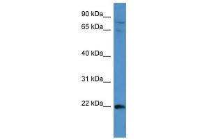 MAP3K15 antibody used at 1 ug/ml to detect target protein. (MAP3K15 antibody  (Middle Region))