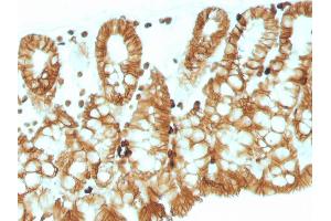 Immunohistochemistry (IHC) image for anti-Epithelial Cell Adhesion Molecule (EPCAM) (AA 280-350), (Cytoplasmic Domain) antibody (ABIN6939974)