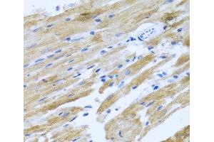 Immunohistochemistry (Paraffin-embedded Sections) (IHC (p)) image for anti-MOK Protein Kinase (MOK) antibody (ABIN7259745)