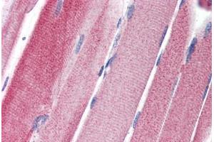 Human Skeletal Muscle (formalin-fixed, paraffin-embedded) stained with GPAM antibody ABIN351457 at 5 ug/ml followed by biotinylated goat anti-rabbit IgG secondary antibody ABIN481713, alkaline phosphatase-streptavidin and chromogen. (GPAM antibody  (C-Term))