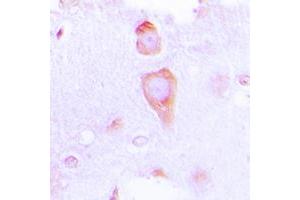 Immunohistochemical analysis of GUCY1B3 staining in human brain formalin fixed paraffin embedded tissue section. (GUCY1B3 antibody  (N-Term))