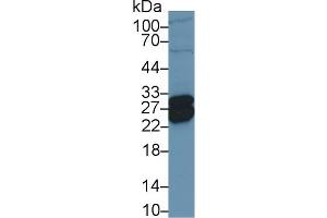 Detection of TNNI1 in Porcine Heart lysate using Polyclonal Antibody to Troponin I Type 1, Slow Skeletal (TNNI1) (TNNI1 antibody  (AA 1-187))