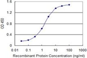 Detection limit for recombinant GST tagged DYRK1B is 0. (DYRK1B antibody  (AA 479-569))