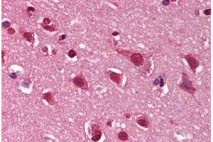Human Brain, Cortex (formalin-fixed, paraffin-embedded) stained with DNM1 antibody ABIN291352 at 10 ug/ml followed by biotinylated goat anti-rabbit IgG secondary antibody ABIN481713, alkaline phosphatase-streptavidin and chromogen. (Dynamin 1 antibody  (C-Term))