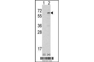 Image no. 1 for anti-tyrosine Kinase, Non-Receptor, 2 (TNK2) (AA 934-964) antibody (ABIN2451837) (TNK2 antibody  (AA 934-964))