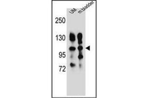 Western blot analysis of CD49e / ITGA5 Antibody (Center) in human uterine tumor and mouse bladder tissue lysates (35ug/lane). (ITGA5 antibody  (Middle Region))