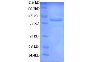 SDS-PAGE (SDS) image for Chymase 1, Mast Cell (CMA1) (AA 22-249) protein (His-SUMO Tag) (ABIN5709295) (CMA1 Protein (AA 22-249) (His-SUMO Tag))