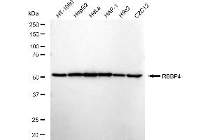 Western blotting analysis using RBBP4 antibody (ABIN7800185). (Recombinant Retinoblastoma Binding Protein 4 antibody)