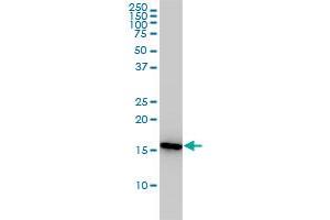 PPIA monoclonal antibody (M01), clone 1F4-1B5 Western Blot analysis of PPIA expression in Jurkat . (PPIA antibody  (AA 1-165))