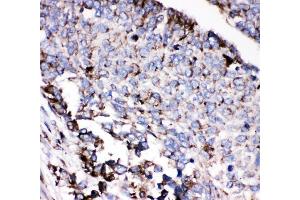 IHC analysis of AEBP2 using anti-AEBP2 antibody (ABIN4886435). (AEBP2 antibody  (AA 424-517))