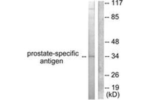 Western blot analysis of extracts from mouse heart cells, using Prostate-specific Antigen Antibody. (Prostate Specific Antigen antibody  (AA 81-130))