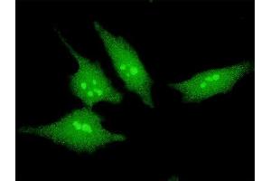 Immunofluorescence of monoclonal antibody to SCAND2 on HeLa cell. (SCAND2 antibody  (AA 1-62))