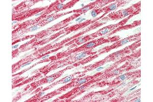 Human, Heart: Formalin-Fixed Paraffin-Embedded (FFPE). (HADH antibody  (C-Term))