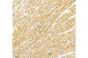 Immunohistochemistry of paraffin embedded rat heart using Sarcomeric α Actinin (ABIN7075510) at dilution of 1: 1000 (200x lens) (Sarcomeric alpha Actinin antibody)
