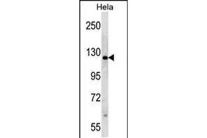 Western blot analysis in Hela cell line lysates (35ug/lane). (PARP1 antibody  (N-Term))