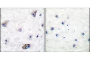 Immunohistochemistry analysis of paraffin-embedded human brain, using GABA-RB (Phospho-Ser434) Antibody.