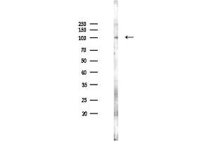 Western blot analysis of lysates from K562 cells(heat-shock 45 min treatment), using Phospho-GluR2 (Ser843) Antibody at 1/1000 dilution.