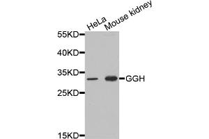 Western blot analysis of extracts of various cell lines, using GGH antibody (ABIN5973177) at 1/1000 dilution. (GGH antibody)