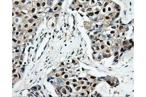Immunohistochemical staining of paraffin-embedded Kidney tissue using anti-HDHD2mouse monoclonal antibody. (HDHD2 antibody)