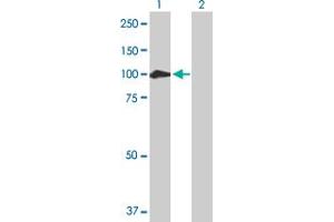 Western Blot analysis of CTNNA2 expression in transfected 293T cell line by CTNNA2 MaxPab polyclonal antibody. (CTNNA2 antibody  (AA 1-905))