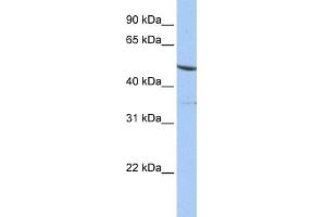 WB Suggested Anti-IFRD1 Antibody Titration: 0. (IFRD1 antibody  (N-Term))