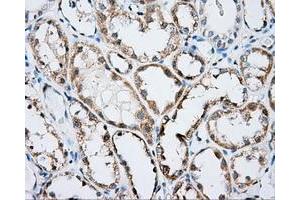 Immunohistochemical staining of paraffin-embedded prostate tissue using anti-ARHGDIA mouse monoclonal antibody. (ARHGDIA antibody)