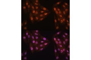 Immunofluorescence analysis of H9C2 cells using MB/MB/ML2 antibody (ABIN6132319, ABIN6143422, ABIN6143424 and ABIN6216232) at dilution of 1:100. (MAD2L2 antibody  (AA 1-211))