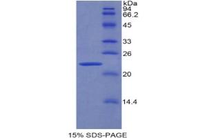SDS-PAGE analysis of Rat PPARG Protein. (PPARG Protein)